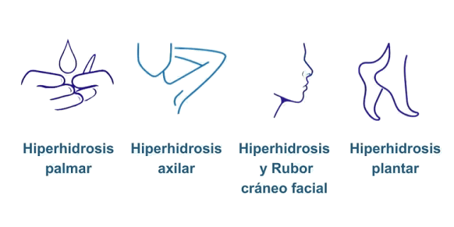 HIPERHIDROSIS